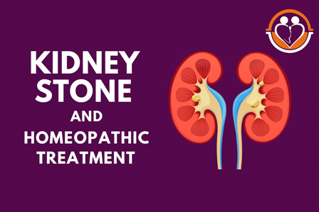 “Kidney stone homeopathy treatment at Carewell Homeopathic Fertility Clinic”