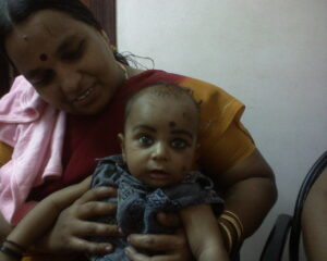 PCOS success stories (Polycystic Ovary Syndrome)