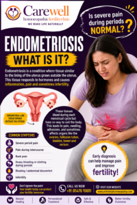 Is severe period pain normal